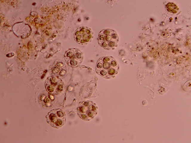 Coelastrum sphaericum